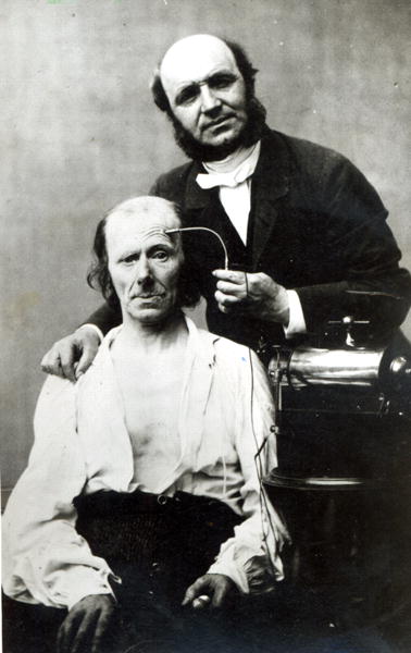 Duchenne de Boulogne with a ''victim patient'', 1862 (b/w photo)  à Photographe français