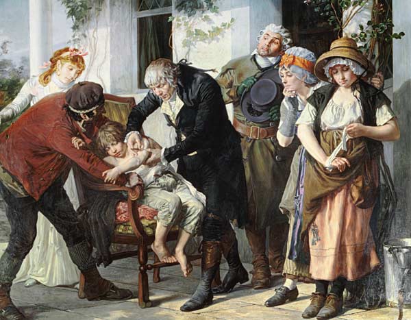 Edward Jenner (1749-1823) performing the first vaccination against Smallpox in 1796 à Gaston Melingue