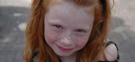 Freckled young lady