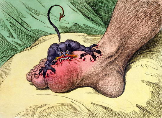 The Gout, published by Hannah Humphrey in 1799 (hand-coloured softdground etching) à James Gillray