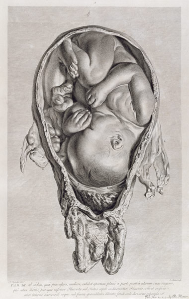 Anatomical drawing of a foetus in the womb à Jan van Rymsdyk
