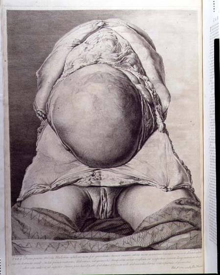 Anatomical drawing of the abdomen of a pregnant female human with skin peeled back à Jan van Rymsdyk
