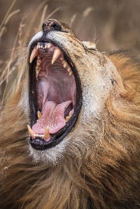 Dental check