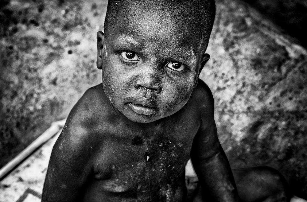 Child from South Sudan à Joxe Inazio Kuesta Garmendia