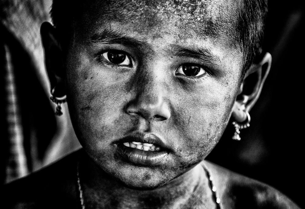 Rohingya refugee girl - Bangladesh à Joxe Inazio Kuesta Garmendia