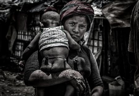 Rohingya refugee mother and her child-Bangladesh