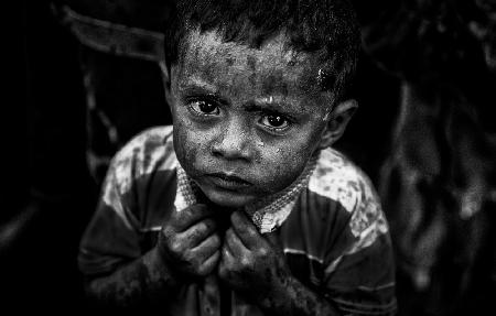 Rohingya boy in the rain.